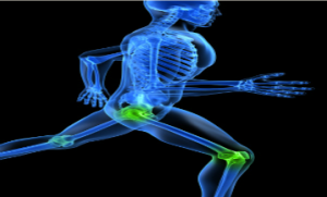 Orthopedic Surgery Billing
